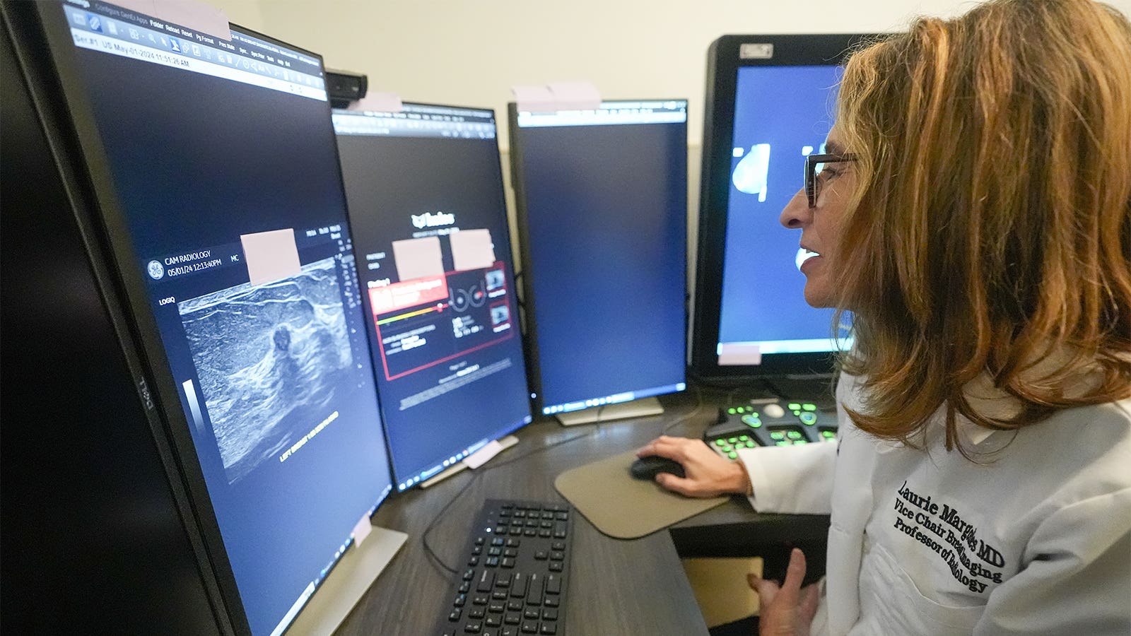 A photo of Dr. Laurie Margolies demonstrating the Koios DS Smart Ultrasound software