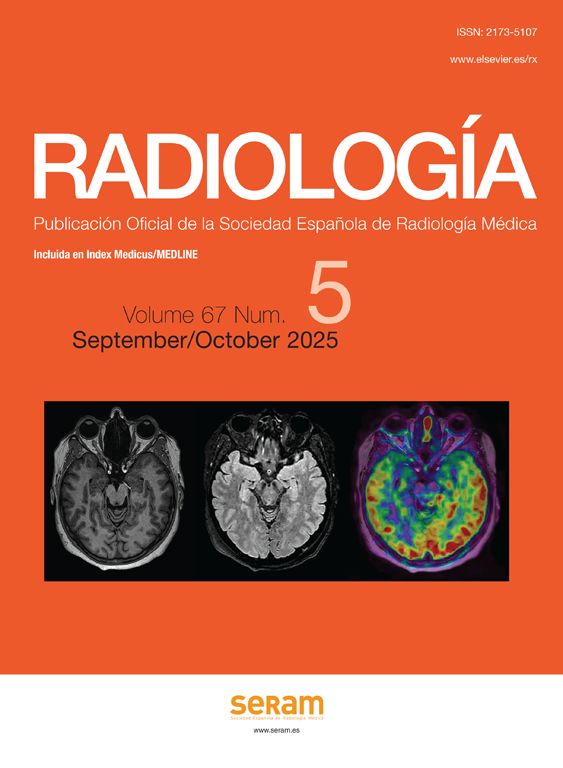 Radiología (English Edition)